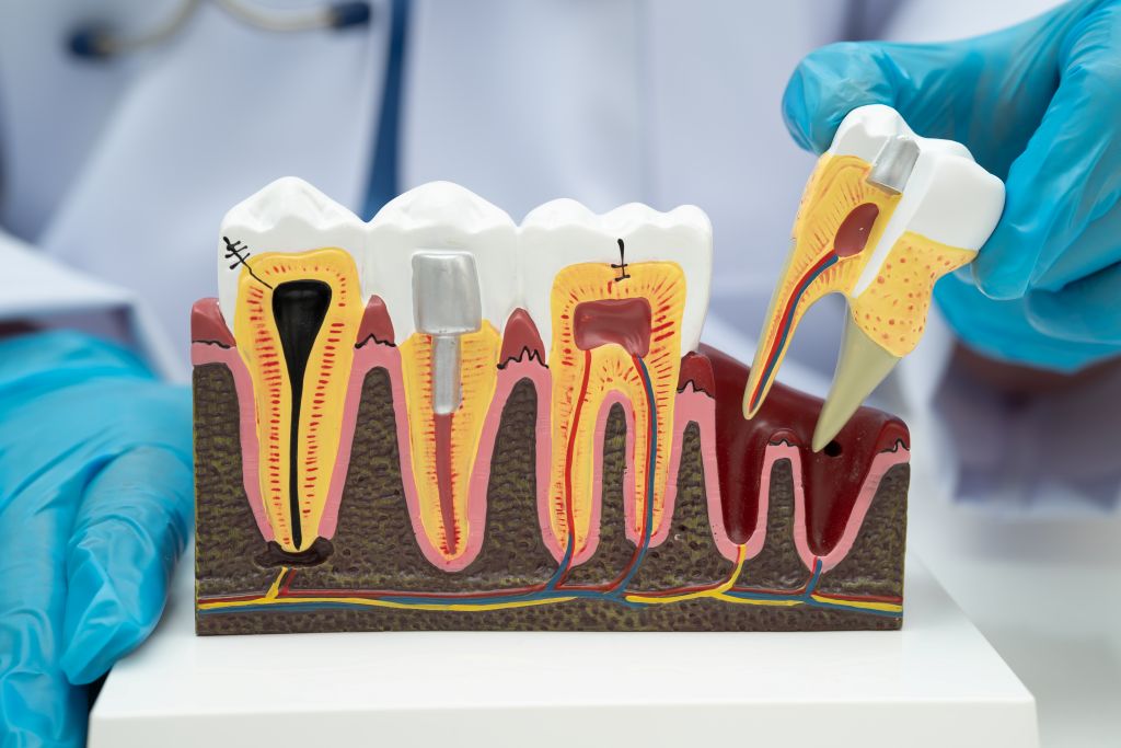 asian dentist holding dental implant artificia teeth