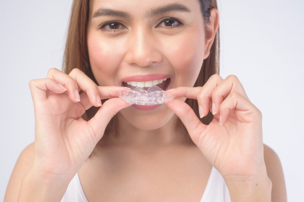 6410753e0381772b8d2ee3a0 occlusal sports guards