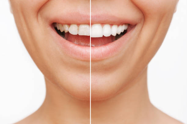 istockphoto 1417956185 612x612